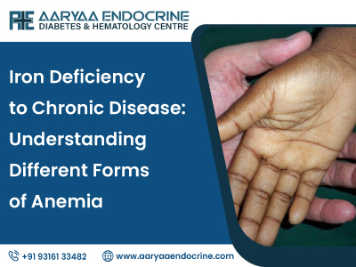 Iron Deficiency to Chronic Disease: Understanding Different Forms of Anemia