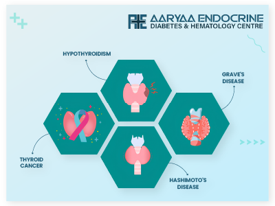 Thyroid Disease