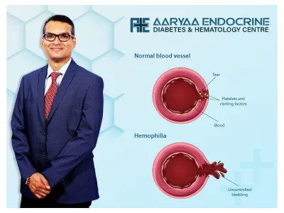 What is Hemophilia? And What Causes It?
