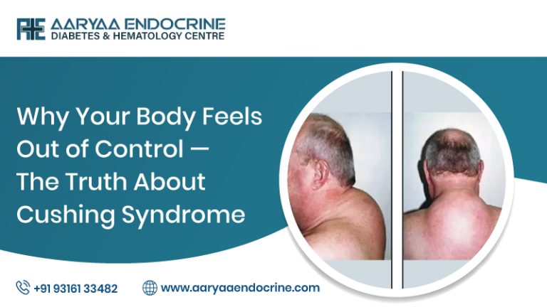 Why Your Body Feels Out of Control — The Truth About Cushing Syndrome