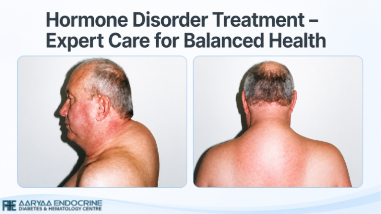 Hormone Disorder Treatment – Expert Care for Balanced Health